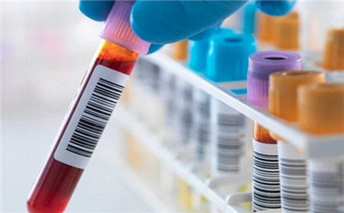 艾滋病是如何感染的？